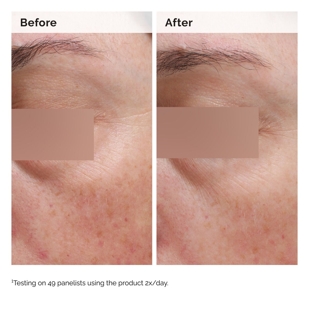 niacinamide-5-face-and-body-emulsion-b5 2024-08-23-ORD-Nia-5pct-Face-Body-B-A-Elasticity-Global-02-1x1.jpg