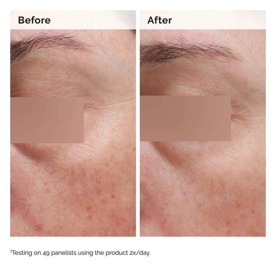 niacinamide-5-face-and-body-emulsion-b5 2024-08-23-ORD-Nia-5pct-Face-Body-B-A-Elasticity-Global-02-1x1.jpg