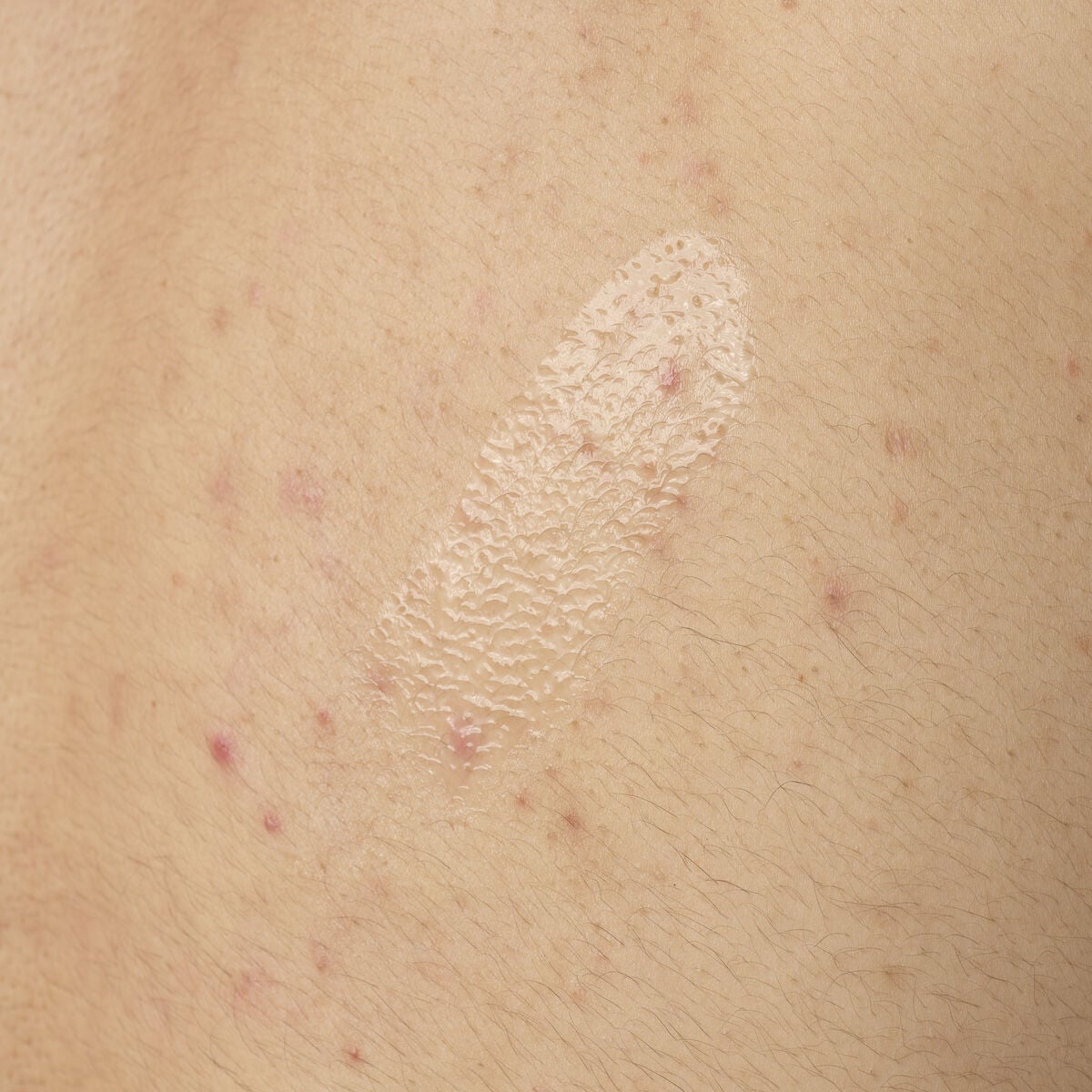 salicylic-acid-0-5-body-serum-u3 ORD-salicylic-acid-05-body-240ml-application.jpg