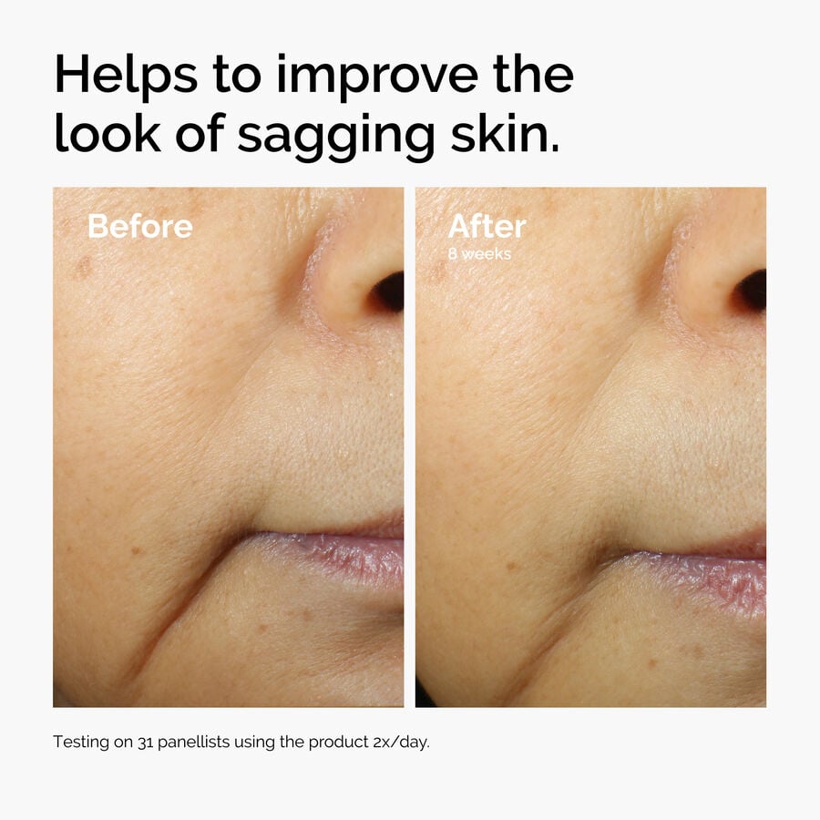 caffeine-3-escin-1-face-serum-k3 ord-caffeine-3pct-escin-1pct-face-serum-before-after-sagging.jpg