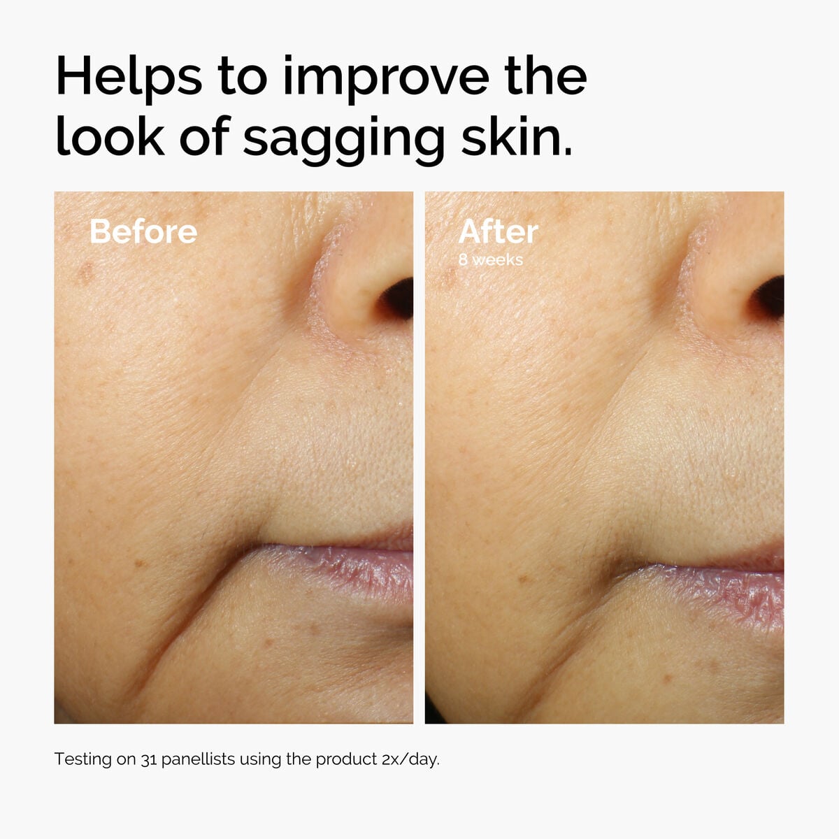 caffeine-3-escin-1-face-serum-k3 ord-caffeine-3pct-escin-1pct-face-serum-before-after-sagging.jpg