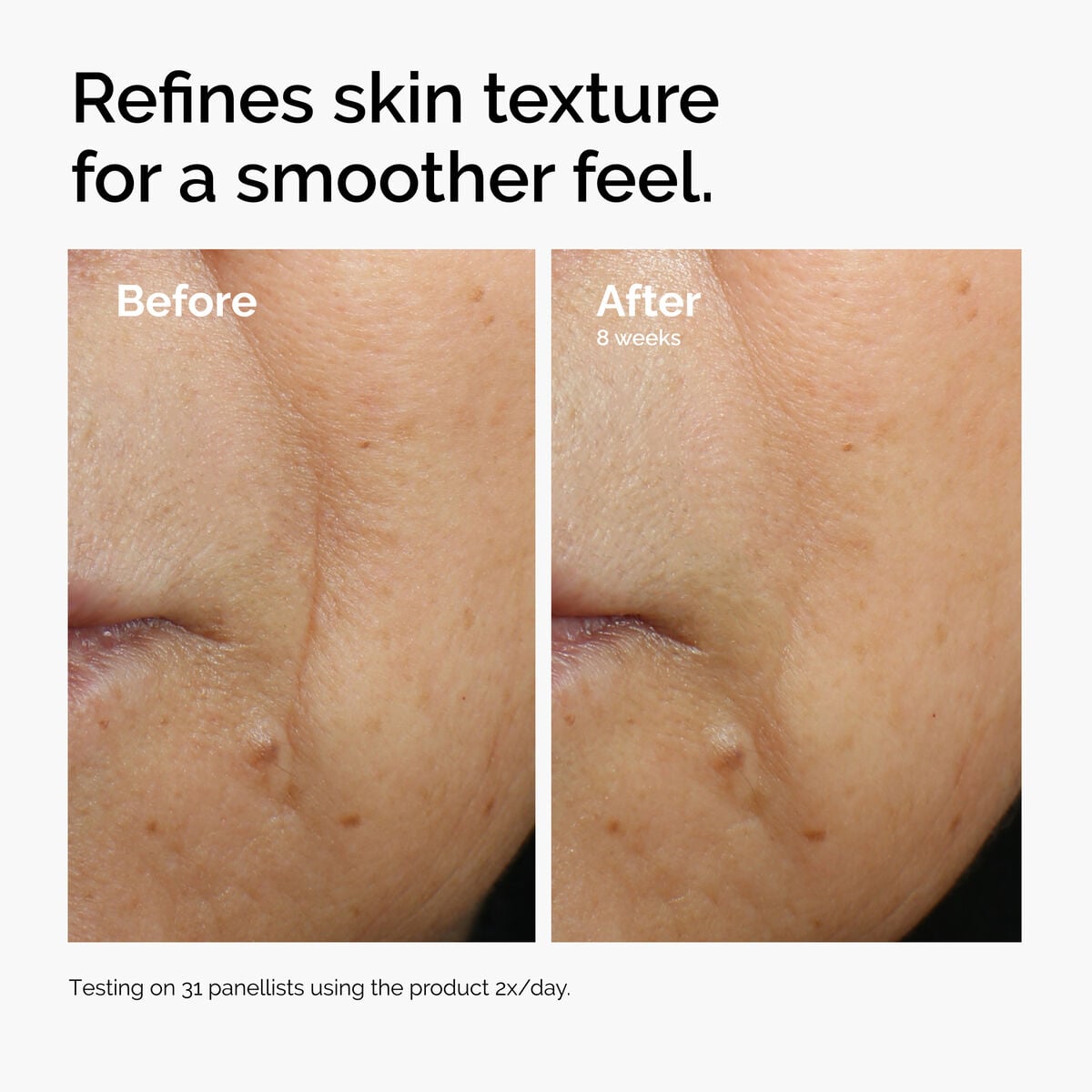 caffeine-3-escin-1-face-serum-k3 ord-caffeine-3pct-escin-1pct-face-serum-before-after-texture.jpg