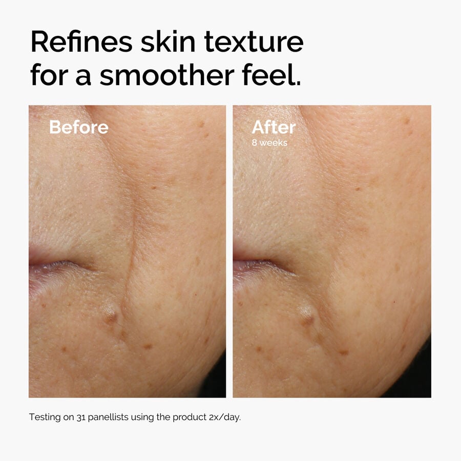 caffeine-3-escin-1-face-serum-k3 ord-caffeine-3pct-escin-1pct-face-serum-before-after-texture.jpg