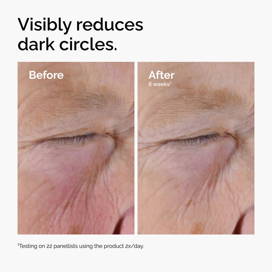 caffeine-solution-5-egcg-eye-serum-o2 ord-caffeine-solution-egcg-dark-circles-before-after.jpg