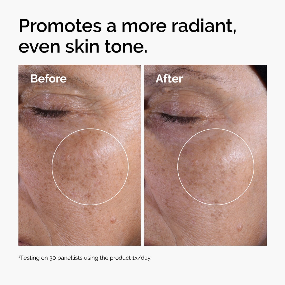 glycolic-acid-7-exfoliating-toner-a2 ord-glycolic-before-after-radiance.jpg