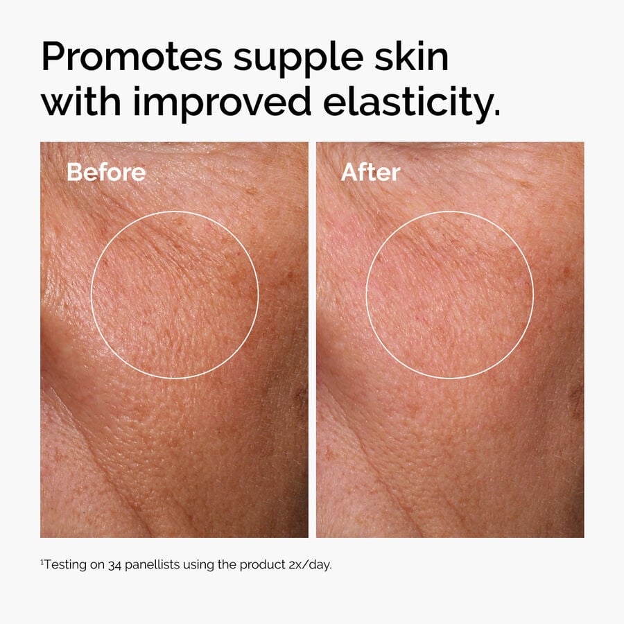 hyaluronic-acid-2-b5-with-ceramides-g7 ord-hyaluronic-acid-2pct-b5-hydrating-serum-before-after-elasticity.jpg