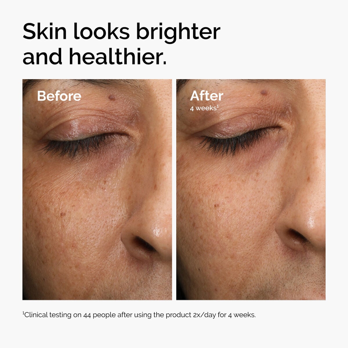 multi-antioxidant-radiance-serum-l5 ord-mars-before-after-healthy.jpg