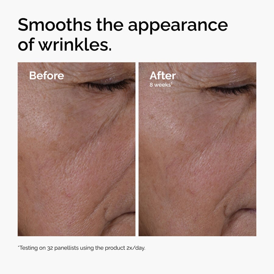 multi-peptide-ha-serum-b2 ord-multi-peptide-ha-serum-wrinkles-before-after.jpg