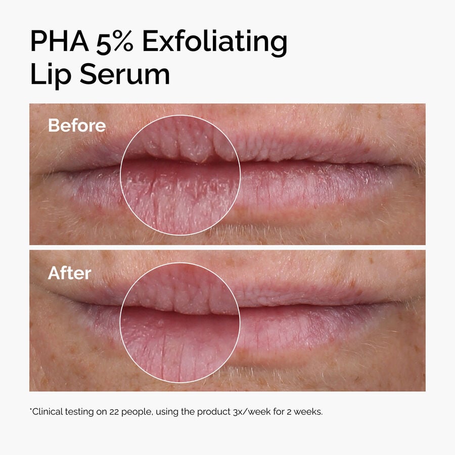 pha-5-exfoliating-lip-serum-m3 ord-pha-5pct-lip-exfoliating-serum-before-after.jpg
