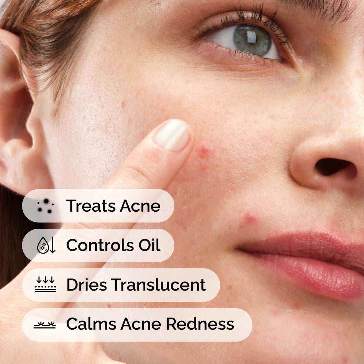 sulfur-10-powder-to-cream-concentrate-x7 ord-sulfur-10pct-powder-to-cream-concentrate-model-application-with-benefits-acne.jpg